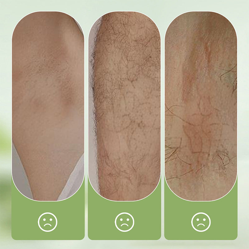 SeidenGlatt™ Haarentfernungs-Set – Sanfte und hautfreundliche Haarentfernung für seidig glatte Haut